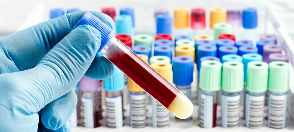 коагулограмма