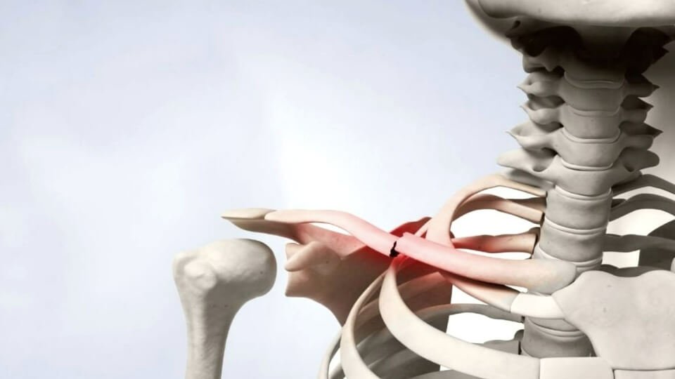 Ключица – що це таке, де вона знаходиться і чому така важлива для тіла ключица